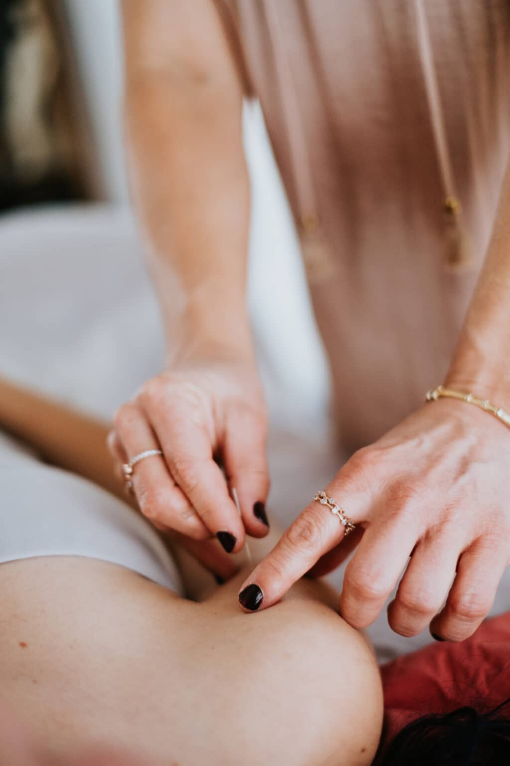 An acupuncturist guiding a fine needle into a patient’s shoulder